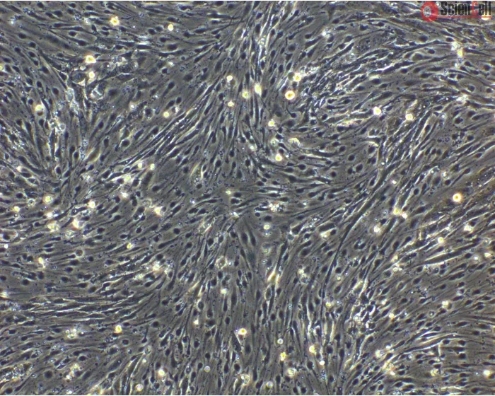 hPSC-Derived Endothelial Cells (hPSC-EC) - Phase contrast, 100x