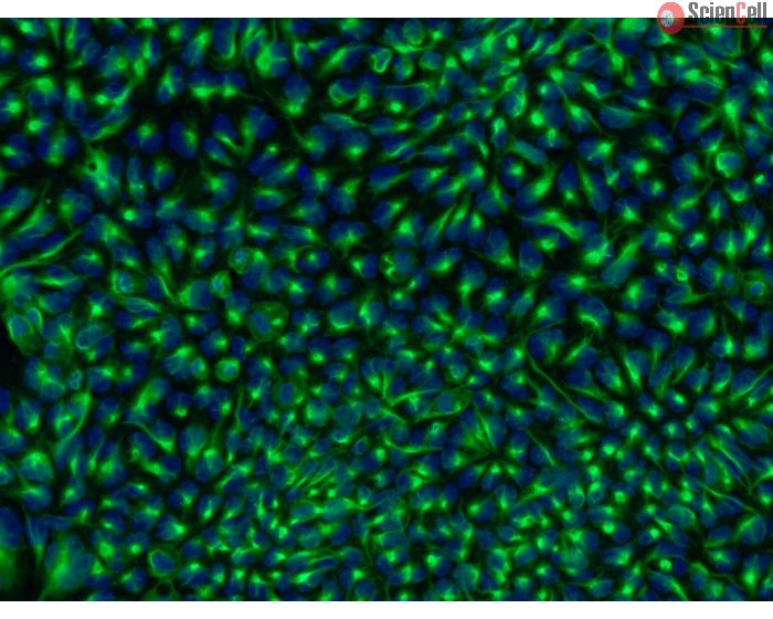 HPSC-Derived Neural Stem Cells (H9-NSC) – Immunostaining for Nestin, 200x