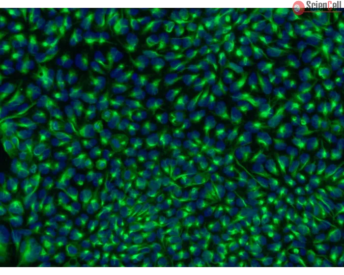 HPSC-Derived Neural Stem Cells (H9-NSC) – Immunostaining for Nestin, 200x