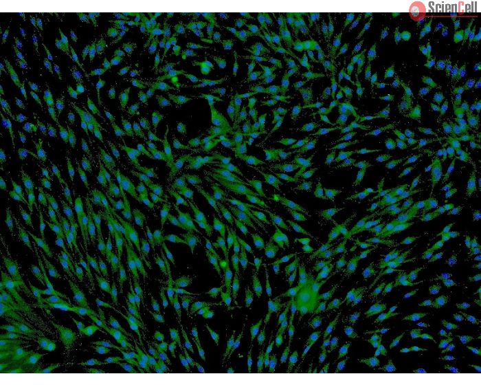 Human Adipose-derived Mesenchymal Stem Cells (HMSC-ad) - Immunostaining for CD73
