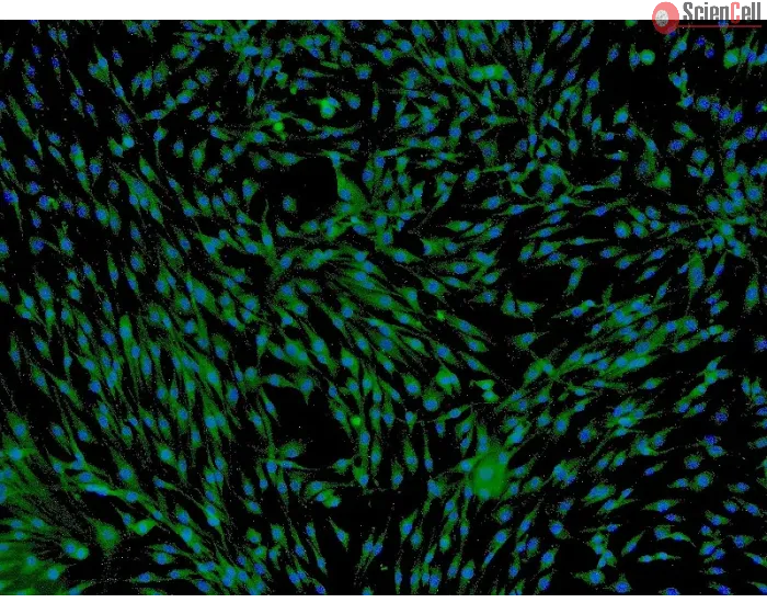 Human Adipose-derived Mesenchymal Stem Cells (HMSC-ad) - Immunostaining for CD73, 100x.