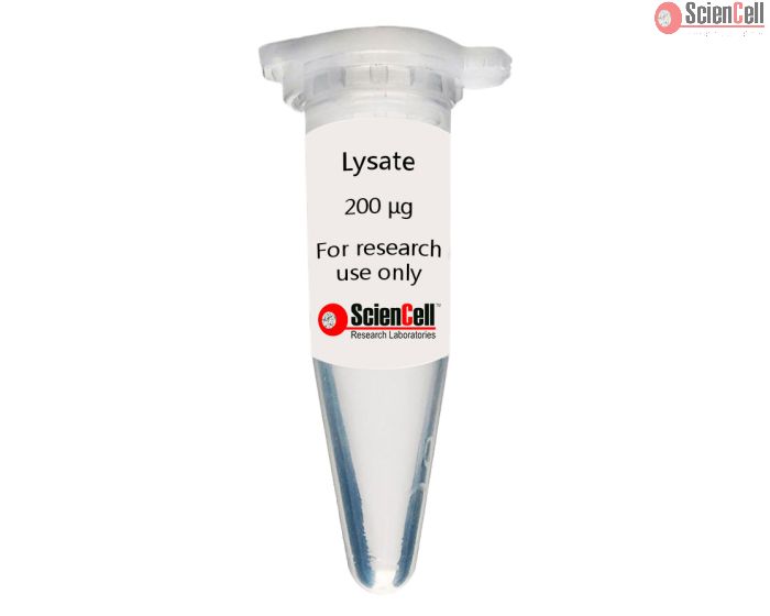 Human Adipose Microvascular Endothelial Cell Lysate