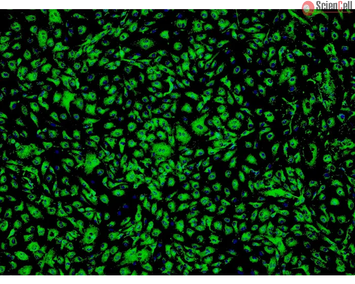 Human Adipose Microvascular Endothelial Cells (HAMEC) - Immunostaining for vWF, 100x.
