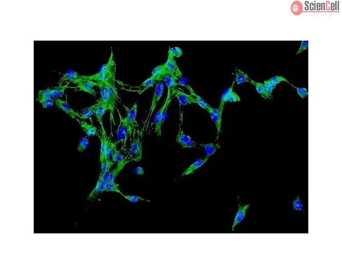 Human Adrenal Fibroblasts (HAdF) - Immunostaining for Fibronectin, 200x.
