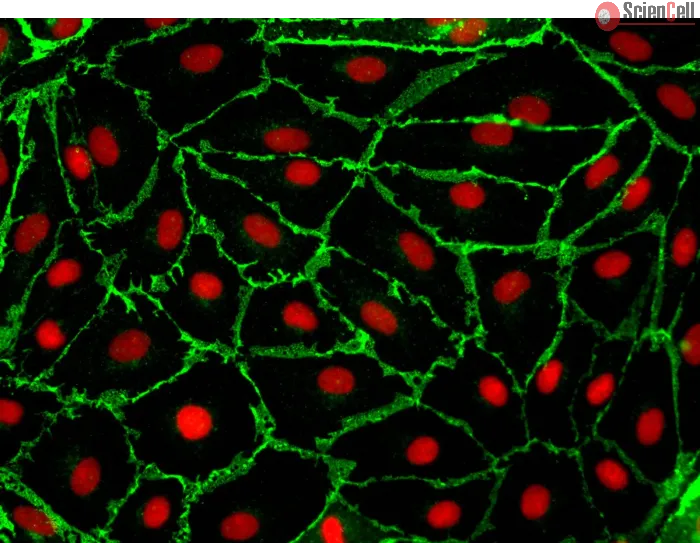 Human Adrenal Microvascular Endothelial Cells (HAdMEC) – Immunostaining for CD31, 400x.
