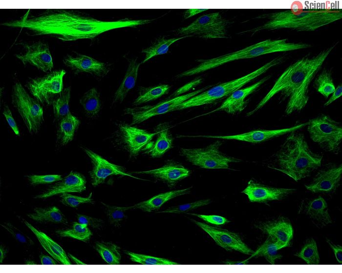 Human Amniotic Epithelial Cells (HAmEpiC) - Immunostaining for CK-18