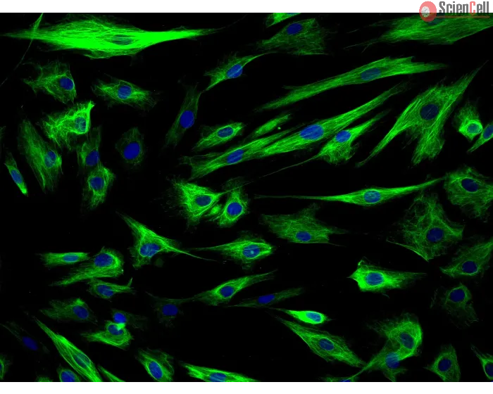 Human Amniotic Epithelial Cells (HAmEpiC) - Immunostaining for CK-18, 200x.

