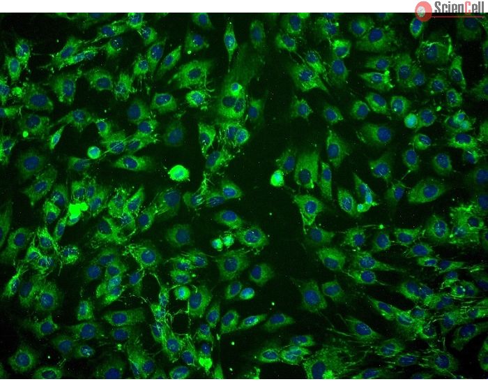Human Amniotic Mesenchymal Stromal Cells (HAMSC) - Immunostaining for CD105