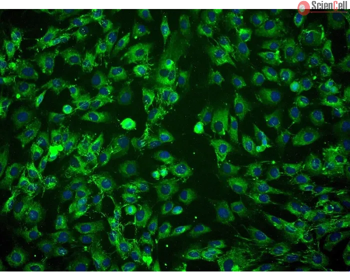 Human Amniotic Mesenchymal Stromal Cells (HAMSC) - Immunostaining for CD105, 200x.
