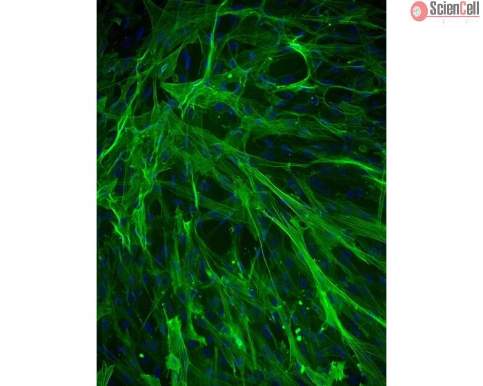 Human Aortic Smooth Muscle Cells (HASMC) - Immunostaining for &alpha;-SMA