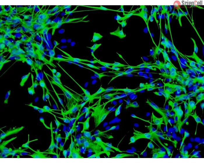 Human Astrocytes-brain stem (HA-bs) - mmunostaining for GFAP, 100x.
