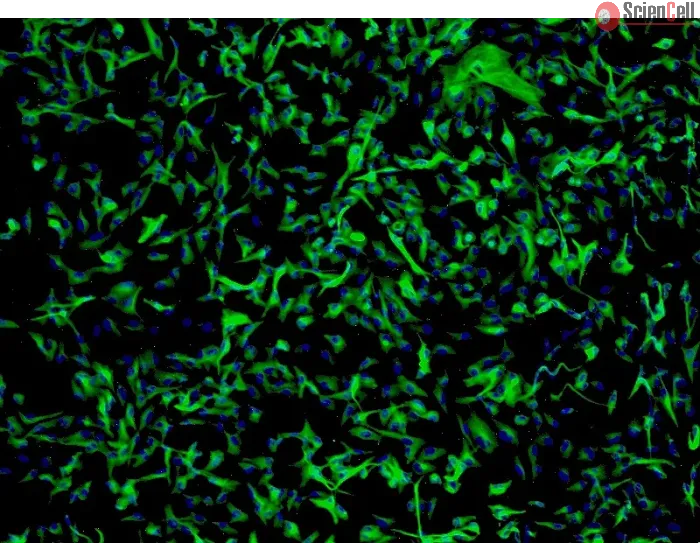 Human Astrocytes-cerebellar (HA-c) - Immunostaining for GFAP, 100x.
