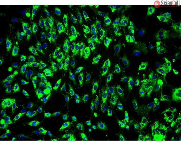 Human Bladder Microvascular Endothelial Cells (HBdMEC) - Immunostaining for Factor VIII