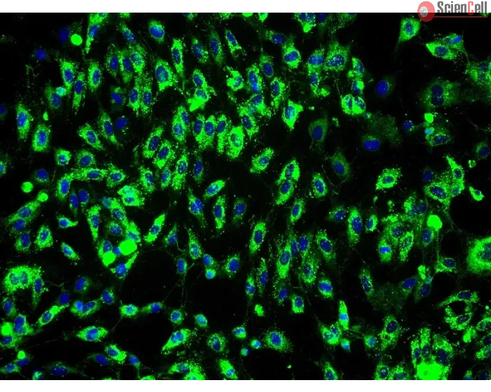 Human Bladder Microvascular Endothelial Cells (HBdMEC) - Immunostaining for vWF, 200x.
