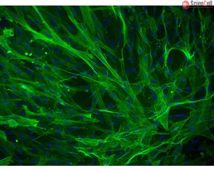 Human Bladder Smooth Muscle Cells (HBdSMC) - Immunostaining for α-SMA, 200x.
