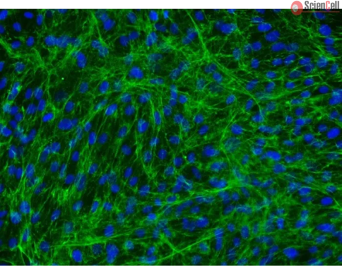 Human Bladder Stromal Fibroblasts (HBdSF) - Immunostaining for Fibronectin, 200x.
