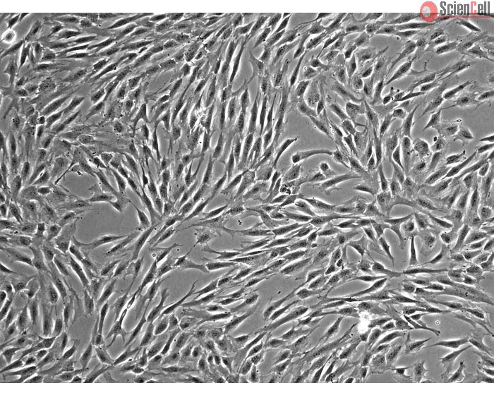 Human Bone Marrow-derived Mesenchymal Stem Cells (HMSC-bm) - Phase contrast