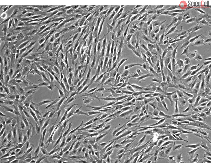 Human Bone Marrow-derived Mesenchymal Stem Cells (HMSC-bm) – Phase contrast, 100x.
