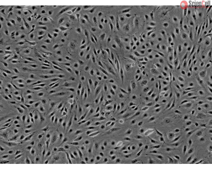Human Brain Microvascular Endothelial cells (HBMEC) - Phase contrast