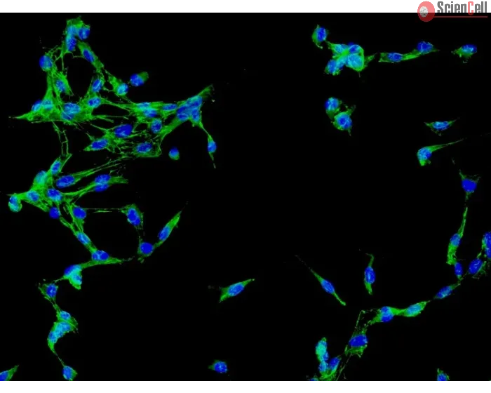 Human Brain Vascular Adventitial Fibroblasts (HBVAF) - Immunostaining for Fibronectin, 200x.
