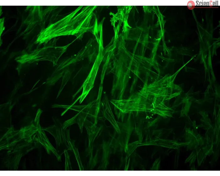 Human Brain Vascular Smooth Muscle Cells [HBVSMC] - Immunostaining for α-SMA, 400x.