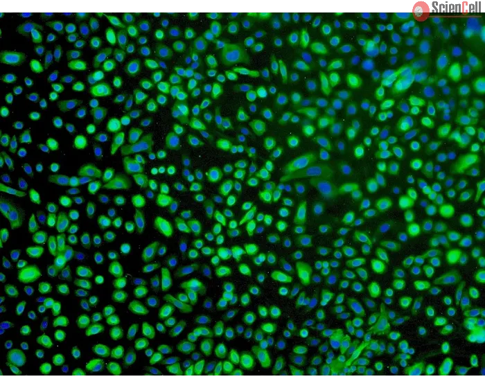 Human Bronchial Epithelial Cells (HBEpiC) - Immunostaining for CK-18, 100x.
