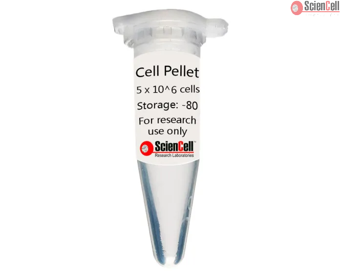 Human Bronchial Fibroblast Cell Pellet