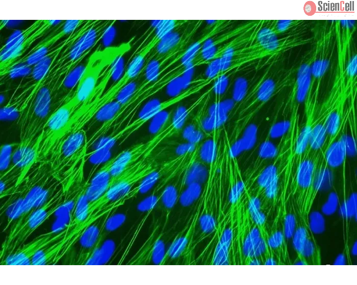 Human Bronchial Smooth Muscle Cells (HBSM) - Immunostaining for .

