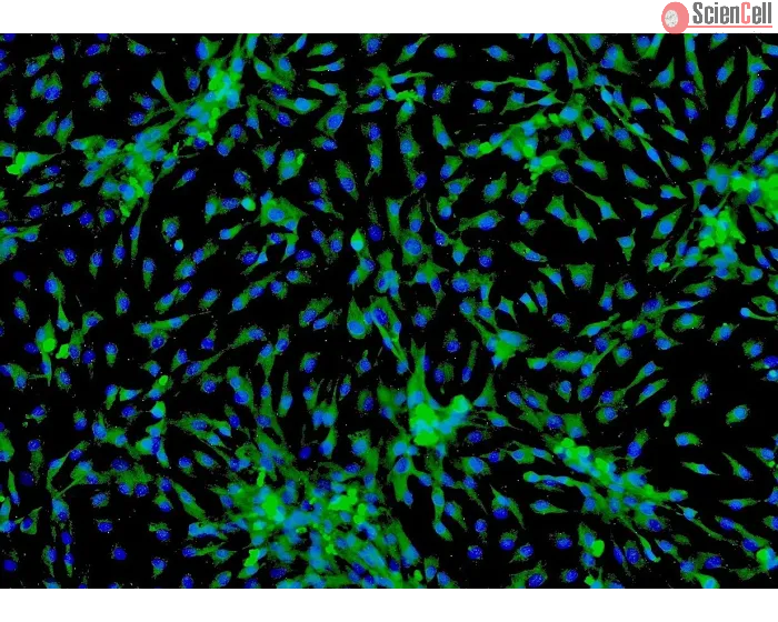 Human Cardiac Myocytes-adult (HCM-a) - Immunostaining for Sarcomeric α-Actinin, 100x.