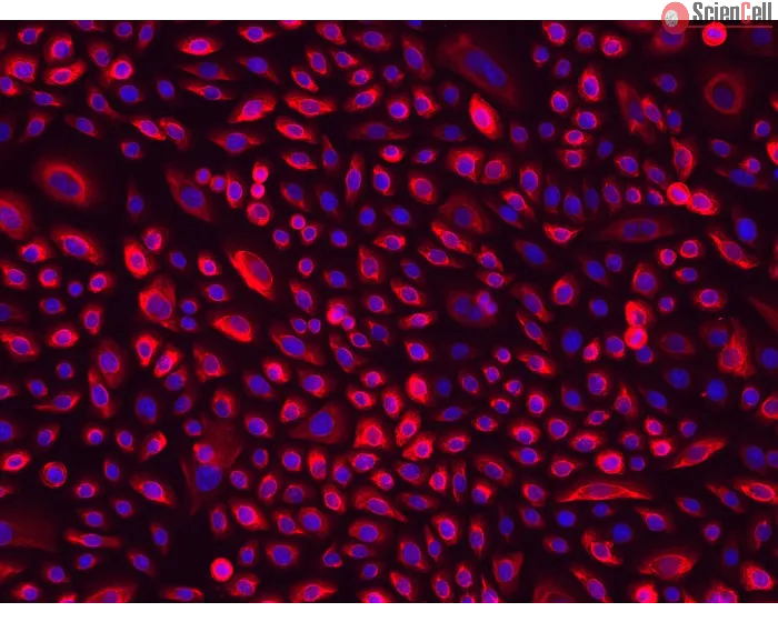 Human Cervical Epithelial Cells (HCerEpiC)-Immunostaining for CK-18, 200x.
