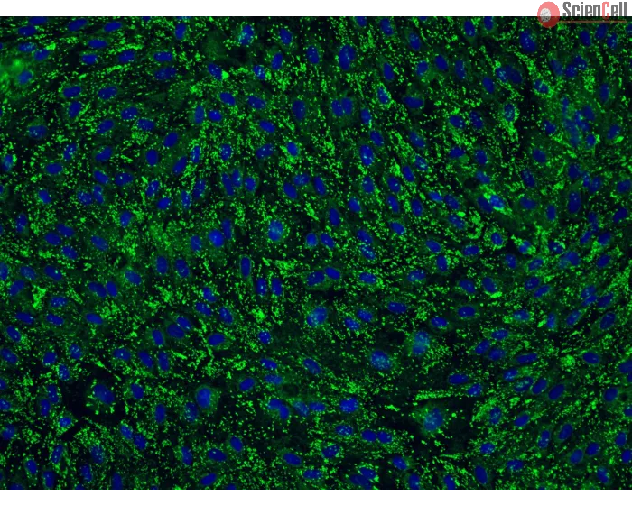 Human Cervical Microvascular Endothelial Cells (HCerMEC)-Immunostaining for vWF, 200x
