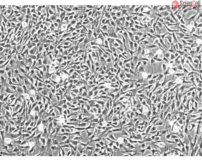 Human Chondrocytes-articular (HC-a) - Phase contrast