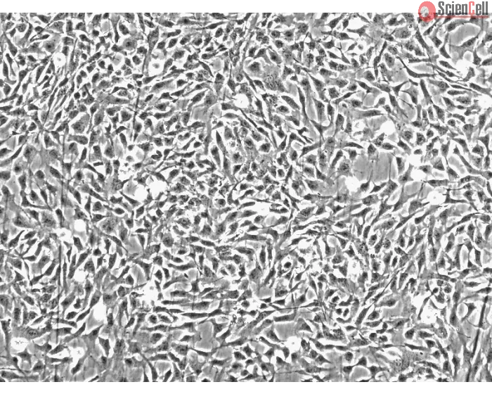 Human Chondrocytes-articular (HC-a) - Phase contrast, 100x.
