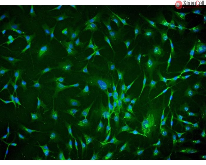 Human Chorionic Mesenchymal Stromal Cells (HCMSC) - Immunostaining for CD105