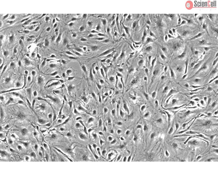 Human Choroid Plexus Endothelial Cells (HCPEC) - Phase contrast