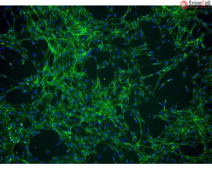 Human Choroid Plexus Fibroblasts (HCPF) - Immunostaining for Fibronectin, 100x.
