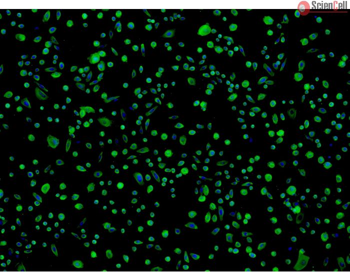 Human Colonic Epithelial Cells (HCoEpiC) - Immunostaining for CK-18