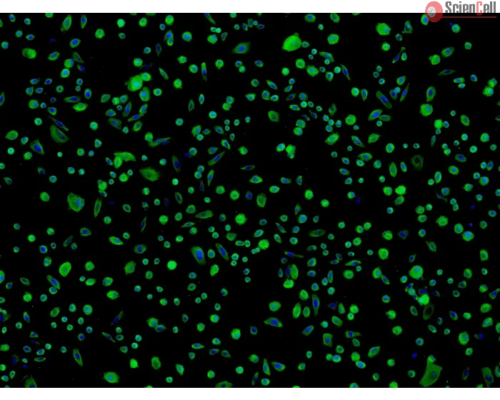 Human Colonic Epithelial Cells (HCoEpiC) - Immunostaining for CK-18, 100x.

