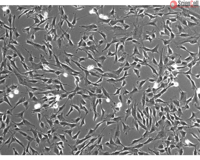 Human Colonic Fibroblasts (HCoF)- Phase Contrast, 100x
