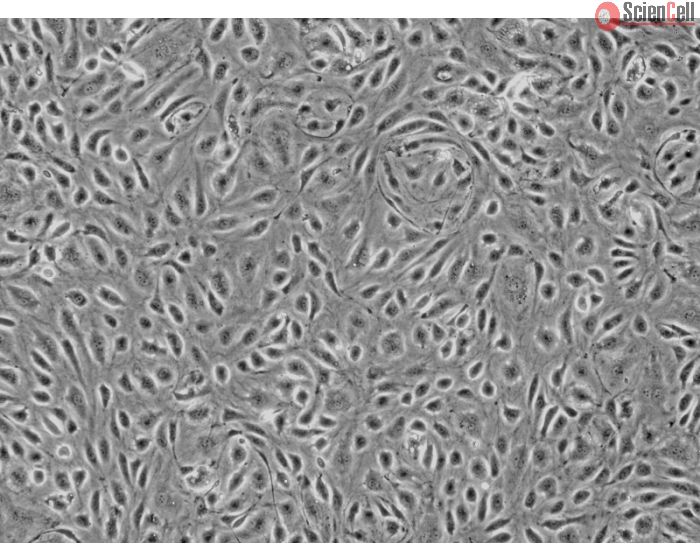 Human Colonic Microvascular Endothelial Cells (HCoMEC) - Phase contrast
