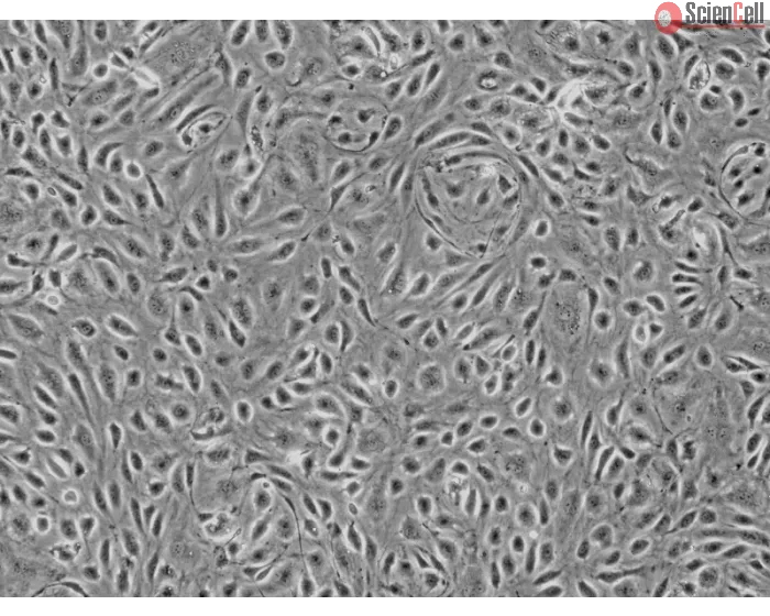 Human Colonic Microvascular Endothelial Cells (HCoMEC) - Phase contrast, 100x.
