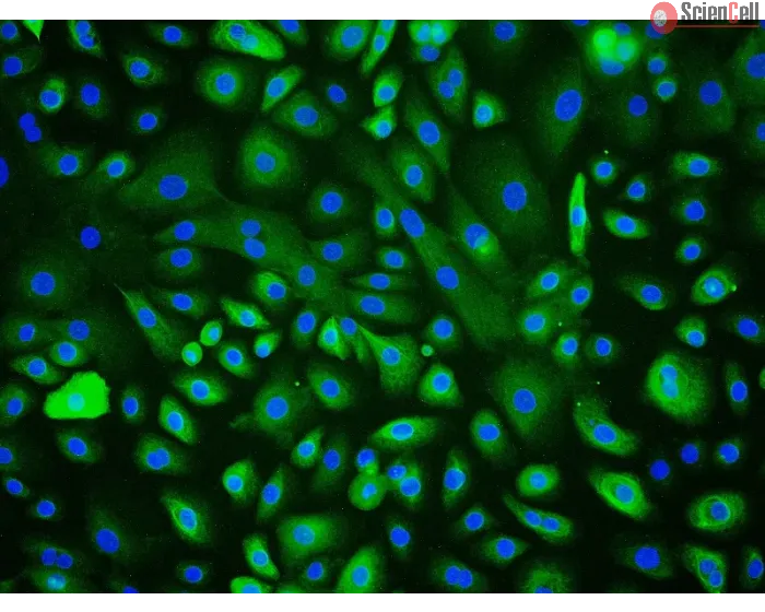 Human Corneal Epithelial Cells (HCEpiC) - Immunostaining for CK-18, 200x.
