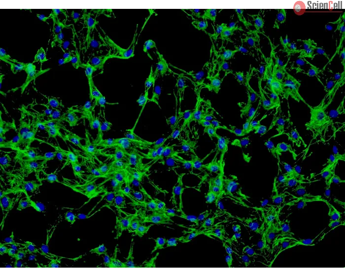 Human Dermal Fibroblasts-adult (HDF-a) - Immunostaining for Fibronectin, 200x.
