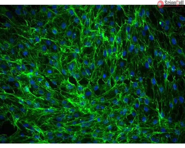 Human Dermal Fibroblasts-Fetal-Mitomycin C treated (HDF-f-mt) - Immunostaining for Fibronectin, 200x.
