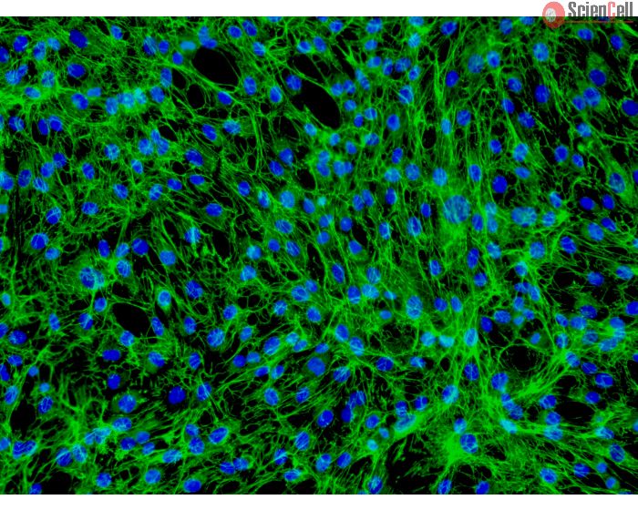 Human Dermal Fibroblasts-neonate (HDF-n) - Immunostaining for Fibronectin