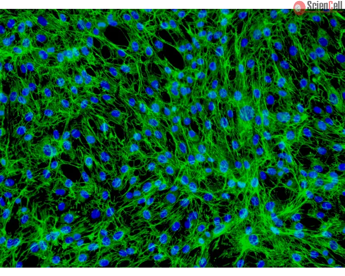 Human Dermal Fibroblasts-neonate (HDF-n) - Immunostaining for Fibronectin, 200x.
