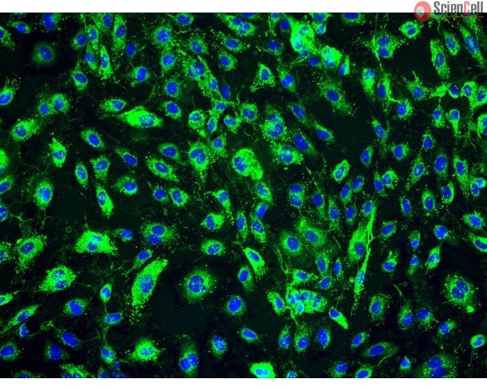 Human Dermal Lymphatic Endothelial Cells (HDLEC) - Immunostaining for Factor VIII
