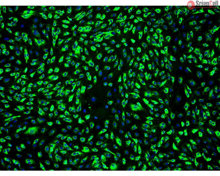 Human Dermal Microvascular Endothelial Cells-adult (HDMEC-a) - Immunostaining for Factor VIII