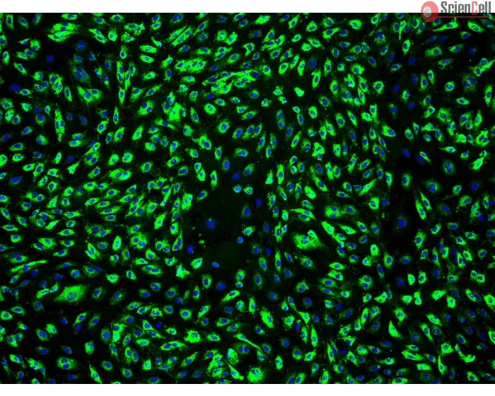 Human Dermal Microvascular Endothelial Cells-adult (HDMEC-a) - Immunostaining for vWF, 100x.
