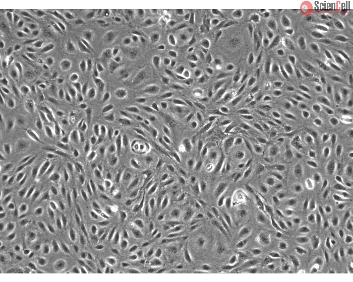 Human Dural Microvascular Endothelial Cells - Phase Contrast